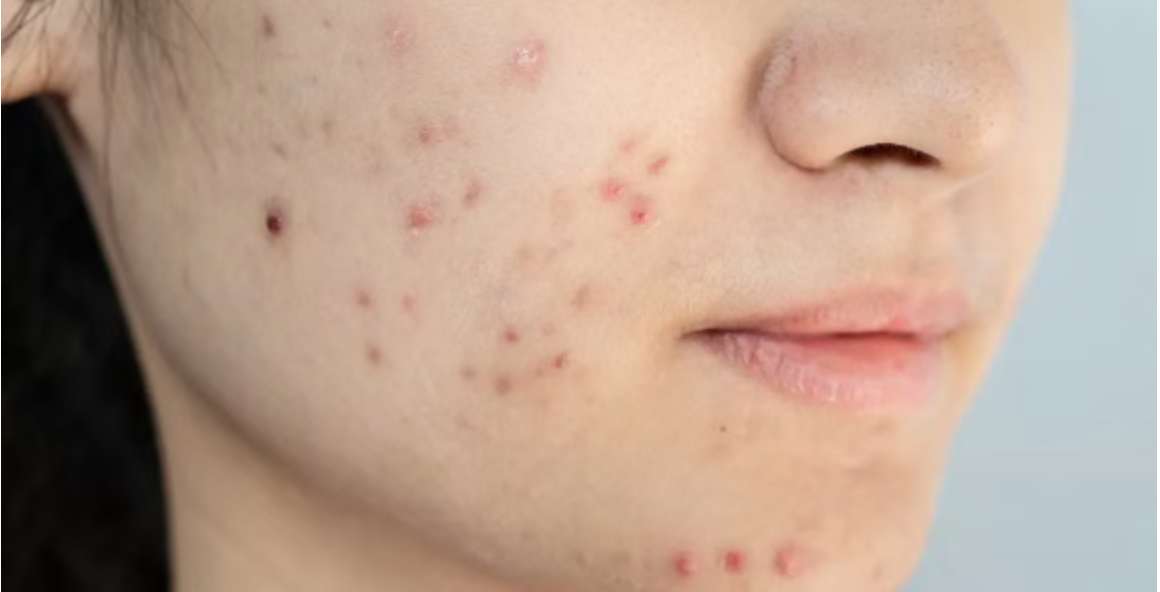 1771898567553323.png ddf23b7936b050151fc0ad9178216768.png